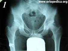 До операции