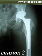 После операции